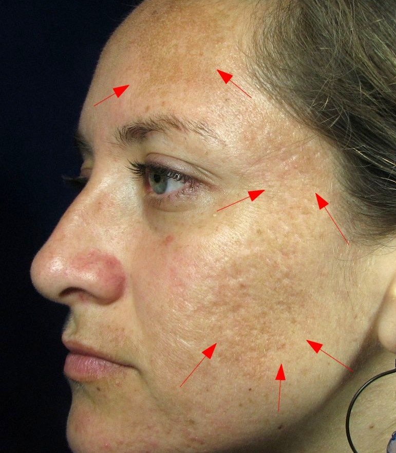 Before "Actual Client"
