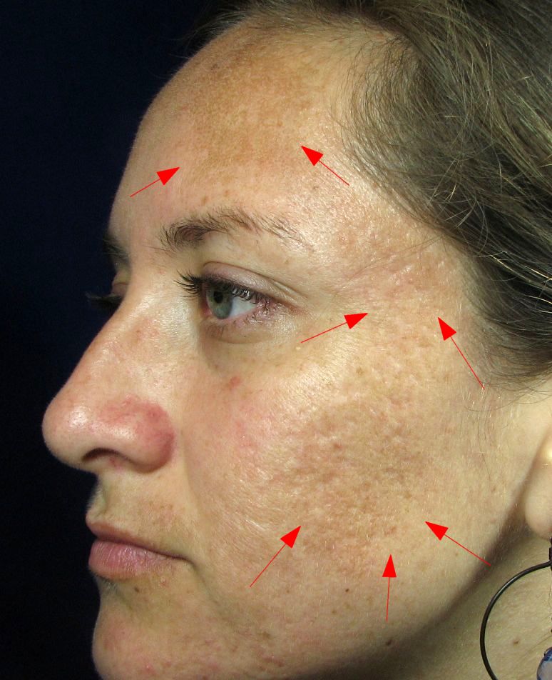 Before "Actual Client"