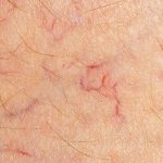 canstockphoto scaled